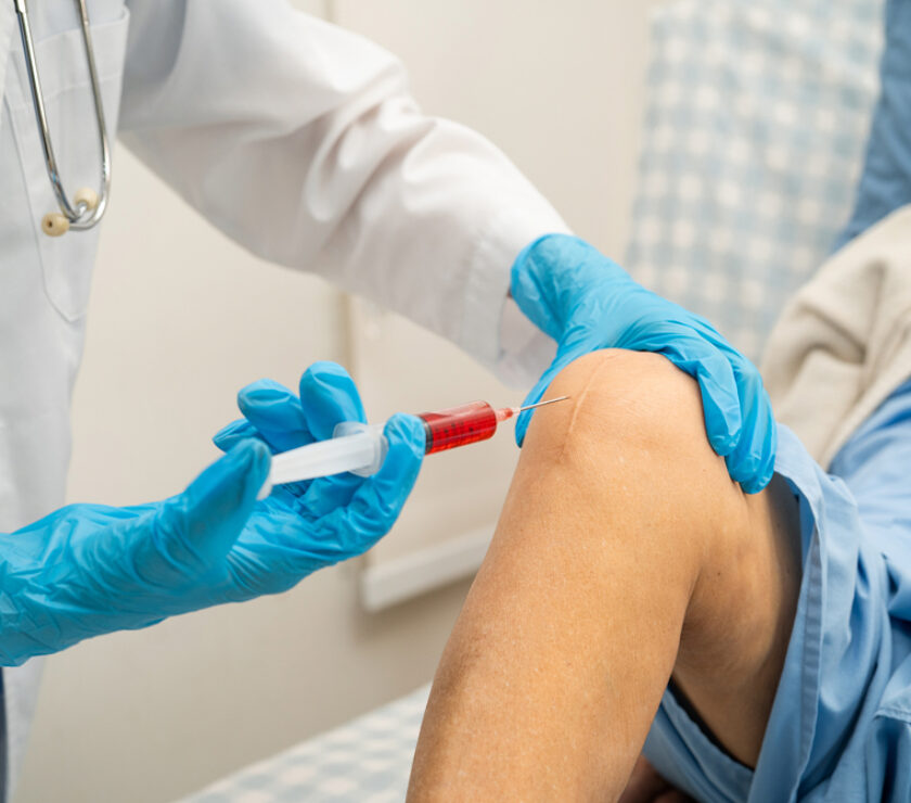 services_prp-and-stem-cell-therapy